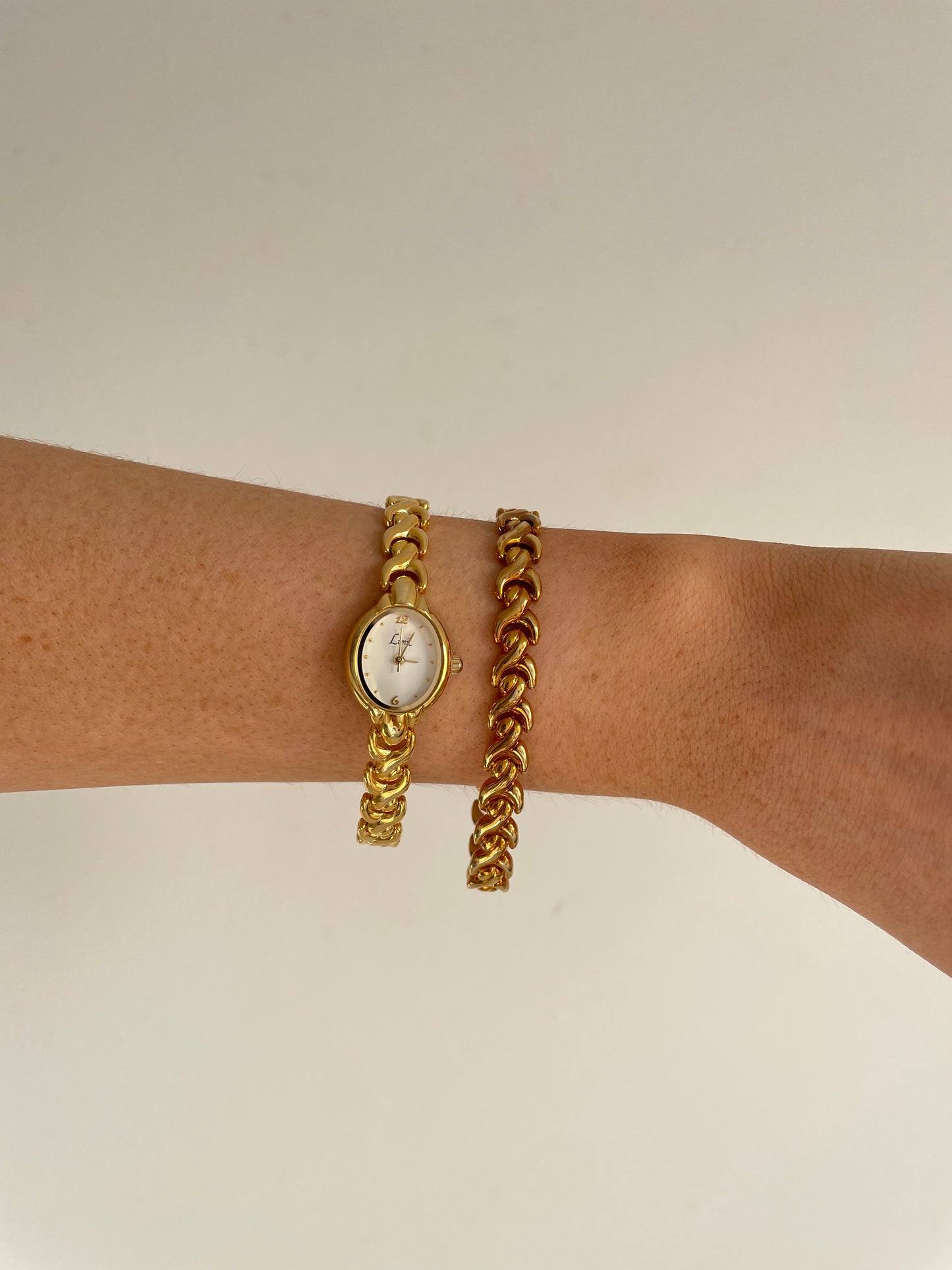 The Sally Anne Watch & Bracelet Set